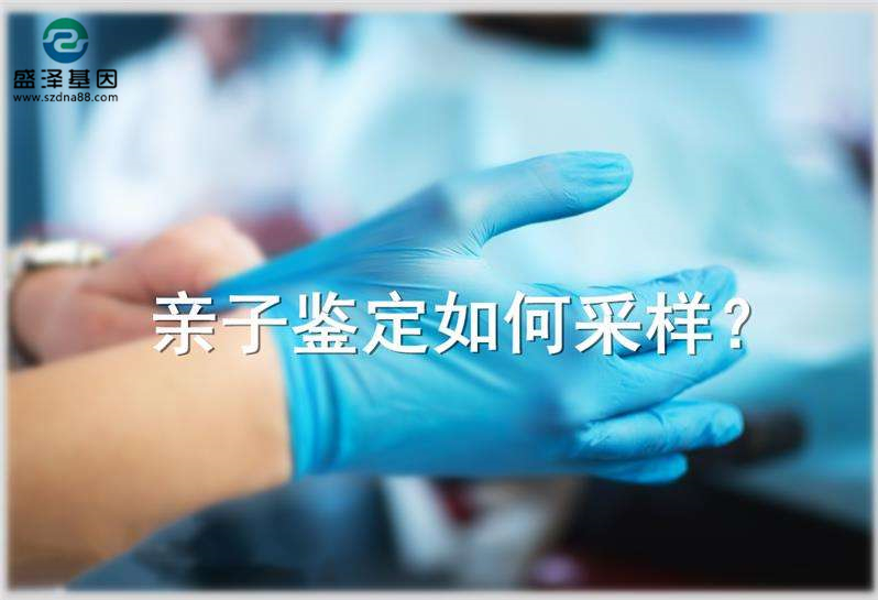 偷偷撿了一把頭發可以送去做親子鑒定嗎？