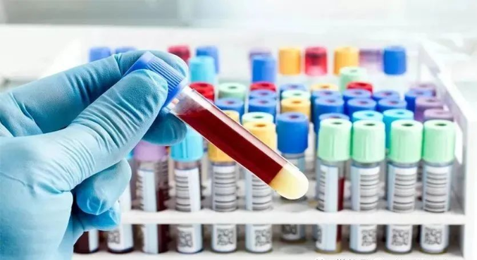 親子鑒定樣本放了一段時(shí)間還能用嗎？