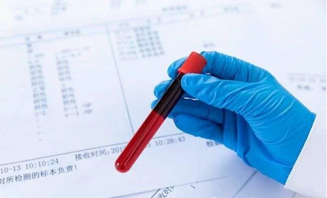 中山石岐做親子鑒定費(fèi)用要多少？石岐親子鑒定多久出結(jié)果？