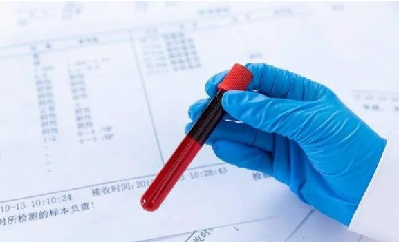 廣東司法親子鑒定大概多少錢？需要哪些手續？