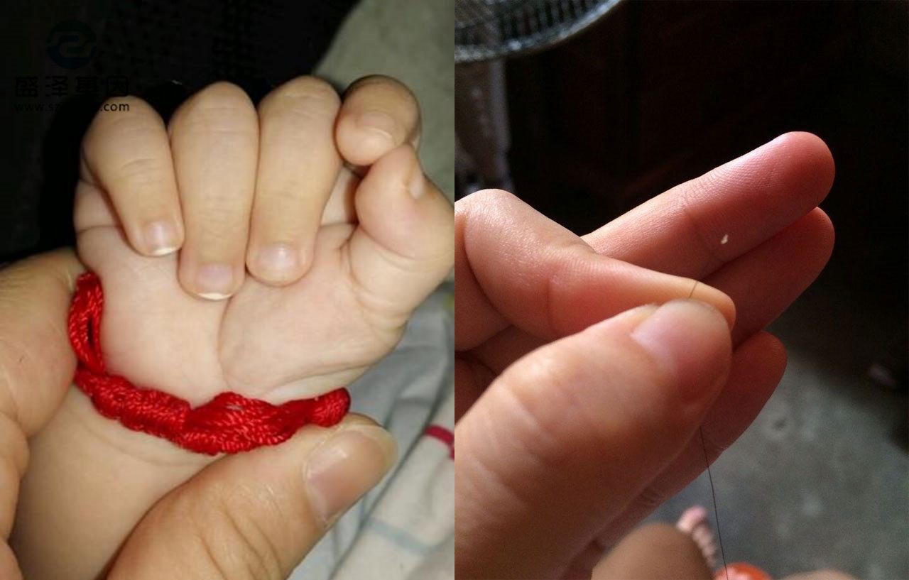 親子鑒定樣本怎么采集?采集頭發(fā) 親子鑒定樣本怎么采集?采集頭發(fā)