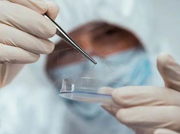 隨便拔下一根帶毛囊的毛發(fā)可以做親子鑒定樣本嗎？