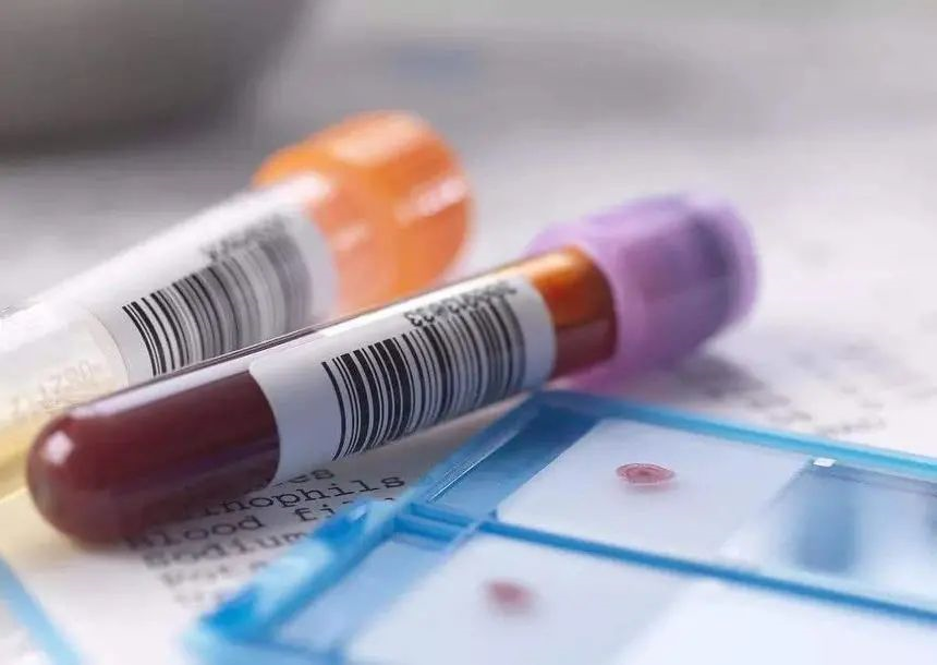 親子鑒定和血型有關(guān)系嗎？給孩子做親子鑒定需要什么樣本？