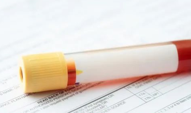 懷孕多久可以做無創(chuàng)胎兒親子鑒定樣本采集？