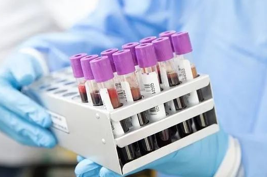 胎兒還沒(méi)有生下來(lái)能不能做親子鑒定采集羊水? 胎兒還沒(méi)有生下來(lái)能不能做親子鑒定采集羊水?