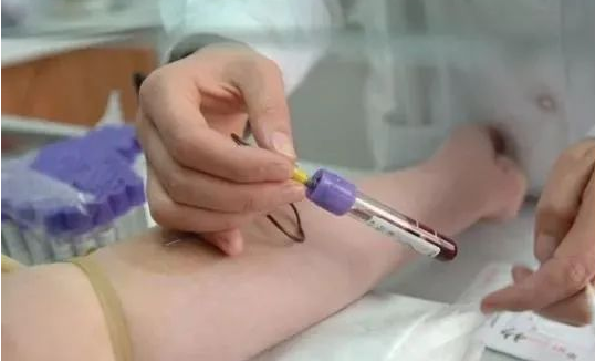 無創(chuàng)胎兒親子鑒定抽血需要孕婦空腹嗎? 無創(chuàng)胎兒親子鑒定抽血需要孕婦空腹嗎?