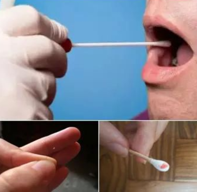 鑒定者郵寄樣本到親子鑒定機構(gòu)有沒有可行性？有哪些好處？