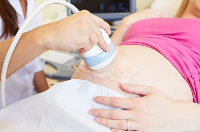 孕媽沈女士求助：懷孕胎兒親子鑒定準確嗎？