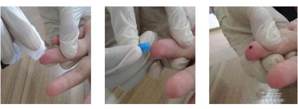 在家怎樣做親子鑒定最簡單？毛發樣本采集好后放入標記好的信封內