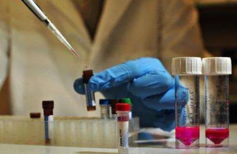 對比血清分類學(xué)測試和白細(xì)胞抗原測試，親子（緣）鑒定靠不靠譜？