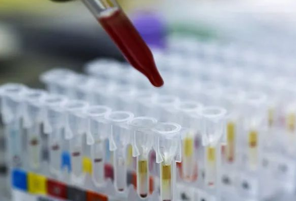 DNA親子鑒定會出錯嗎？根據(jù)樣本檢測位點出錯的概率是多少呢？