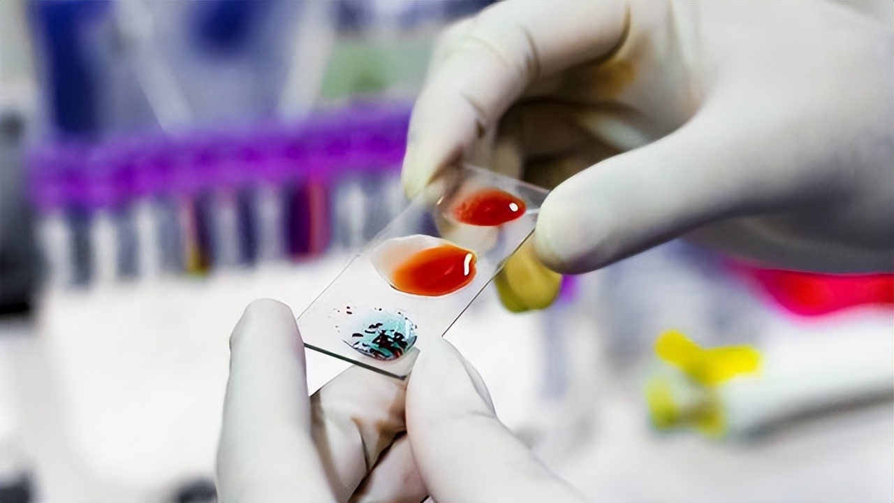 怎么用頭發做中山dna個人隱私親子鑒定？